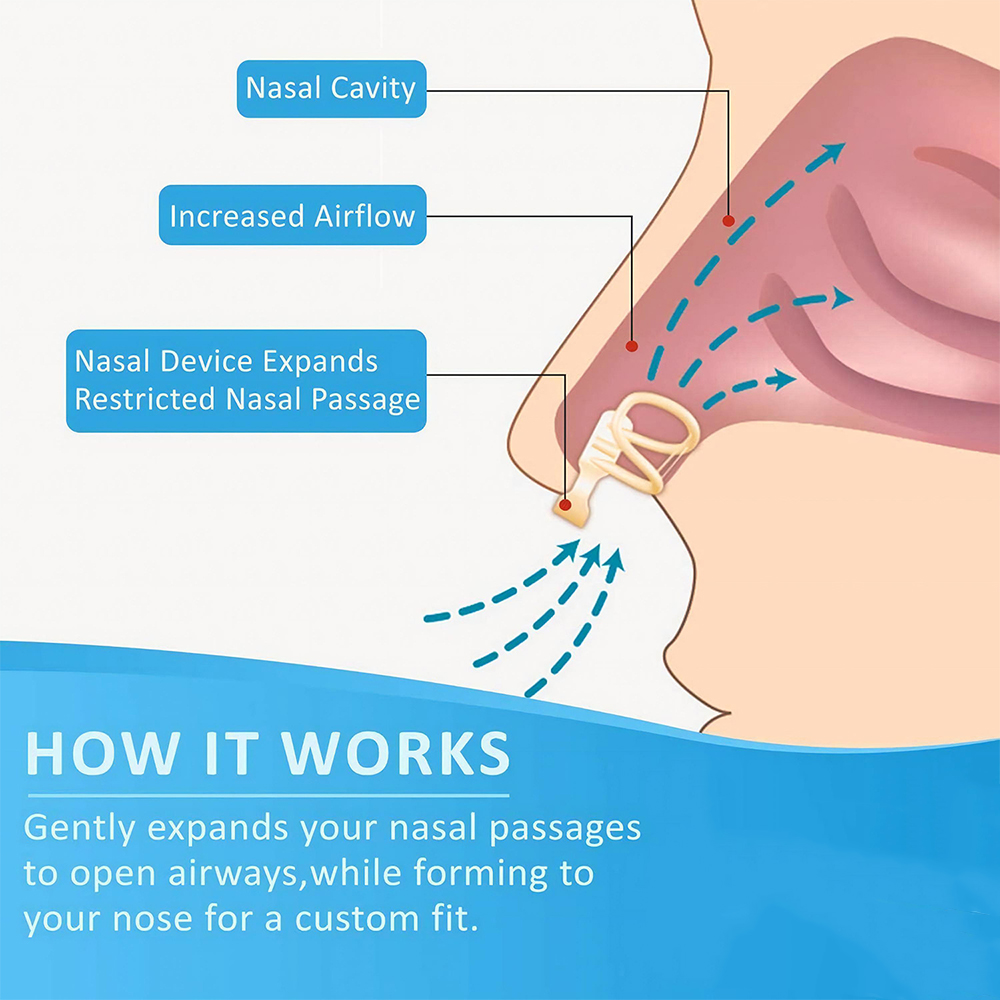 Snurkenstopper Neusdilatator v - Anti Snore Contour Pillow recensie en prijs
